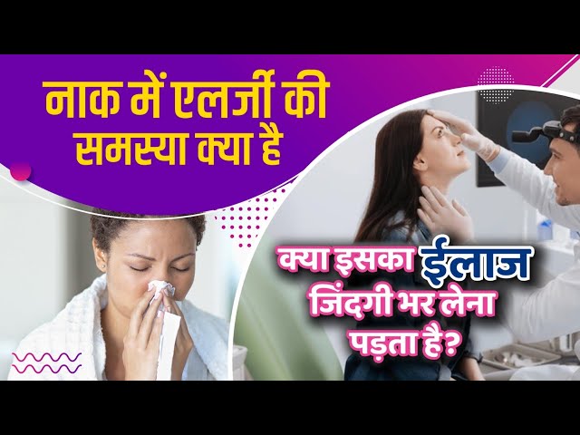 एलर्जी का इलाज बिना दवाई के II Allergic rhinitis से छुटकारा पाने के आसान तरीके