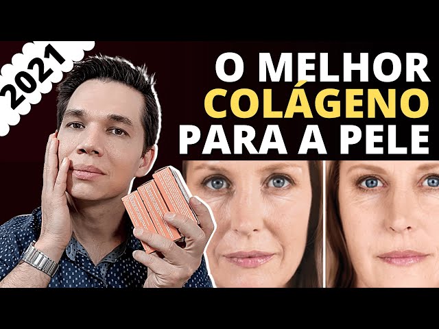 MELHOR COLÁGENO para Pele! 2021 - Qual o mais eficiente? Qual escolher?