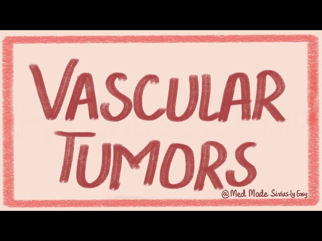 Vascular Tumors- Benign, Intermediate grade and Malignant vascular tumors Pathology