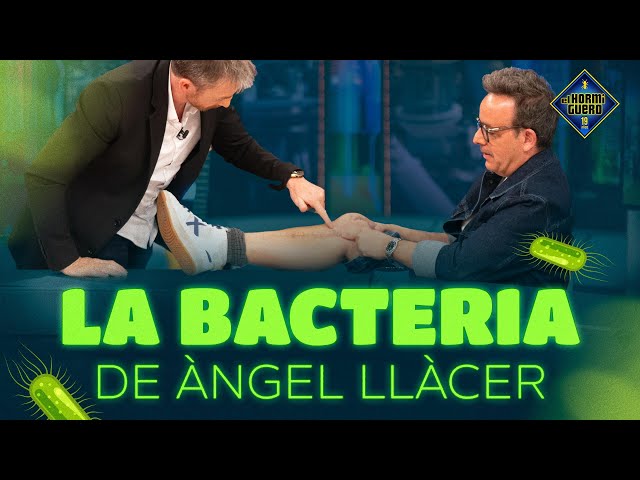 ¡Àngel Llàcer al borde de la muerte! - Àngel Llàcer - El Hormiguero