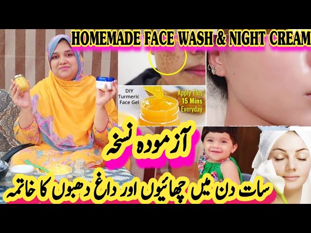 Best Homemade Cream For Freckles and Dark Spots | World Best Remedy for Dull Skin, Glowing Mask #yt