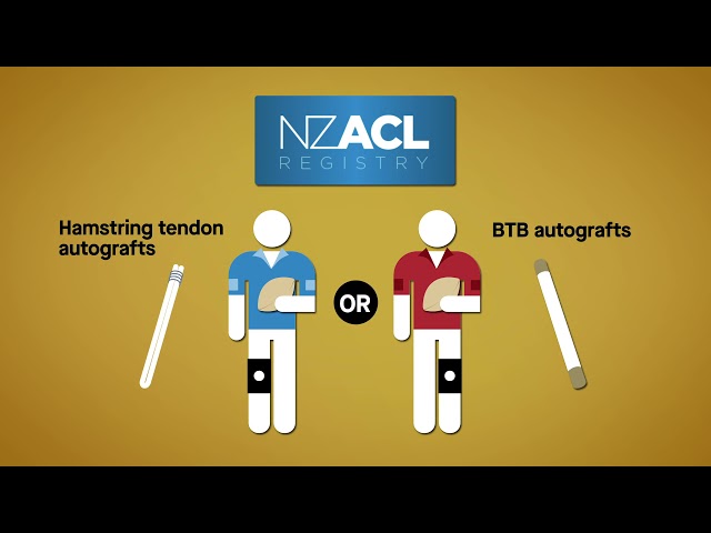 Increased rate of return to activity after bone–patellar tendon–bone ACL reconstruction