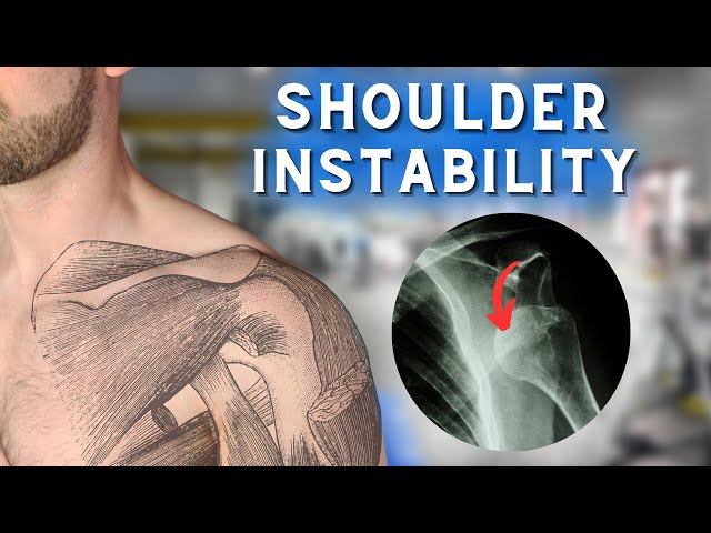 The BEST Exercises For Shoulder Instability!