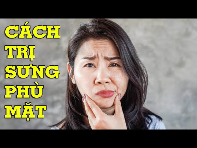 5 cách chữa sưng mặt, phù mặt đơn giản tại nhà - Mẹo Vặt Cuộc Sống