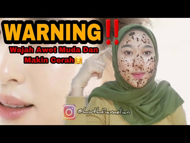 TAK PERLU SUNTIK PUTIH! Cara Mencerahkan Wajah Secara Permanen Dengan Bahan Alami