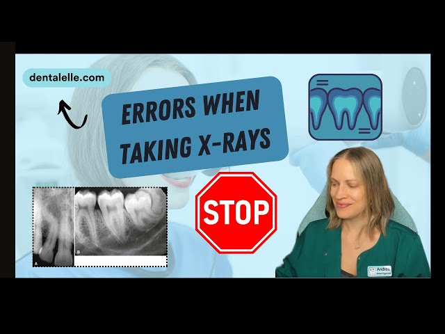 Common Dental X Ray Taking Errors