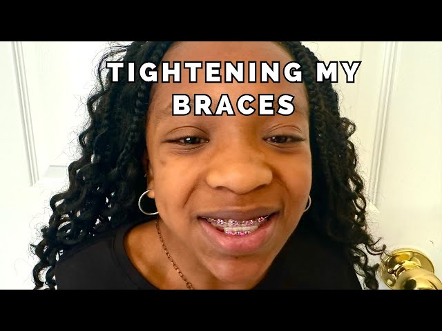 Before & After Braces Tightening | Tween Explains