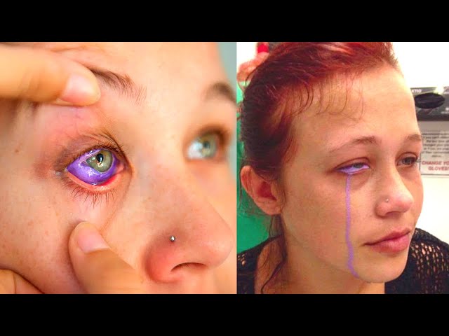 Model Goes Blind Getting Her Eyeballs Tattooed