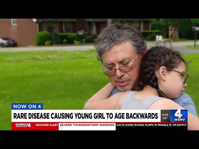 Rare disease causing young girl to age backwards