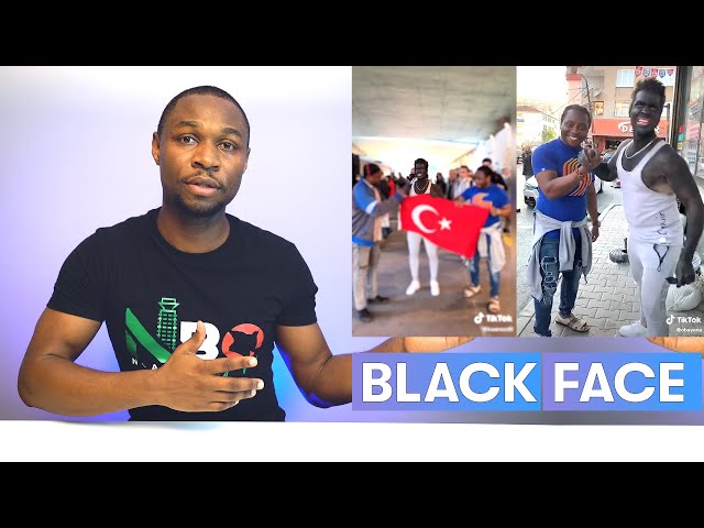 Turkish TIKTOK influencer does BLACKFACE