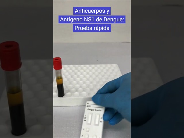 ¿Cómo se hace una prueba rápida de dengue?