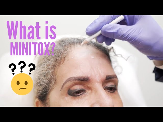 Minitox™?! A natural and safe botox result.(Using Botox, Xeomin, Dysport, or Jeaveau)