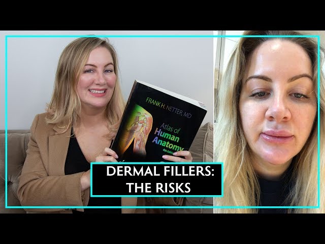 What Could Go Wrong After Having Dermal Fillers?