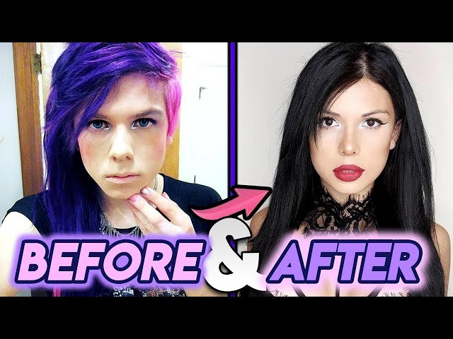 Blaire White | Before and After Transformations | Trans YouTuber Plastic Surgery Transformation