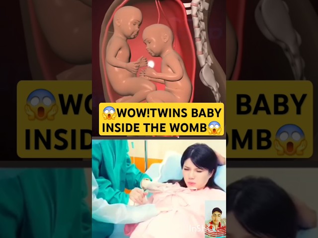 😱WOW!TWINS BABY INSIDE THE WOMB😱