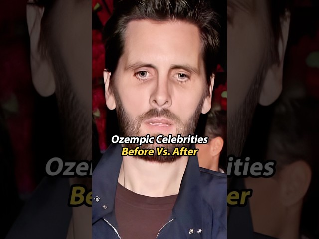 Celebrities Before & After Ozempic! 💉 #celebrity #shorts