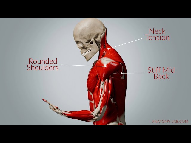 How Your Phone Is Changing Your Posture