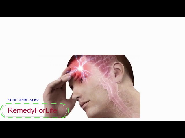 11 Must Known Facts That Causes Headaches Pain On Top Of Your Head - Remedy-For-Life