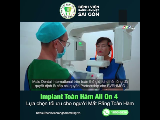 IMPLANT ALL ON 4 có thật sự là lựa chọn tốt cho người mất răng toàn hàm?