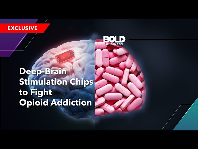 Deep-Brain Stimulation Chips to Fight Opioid Addiction