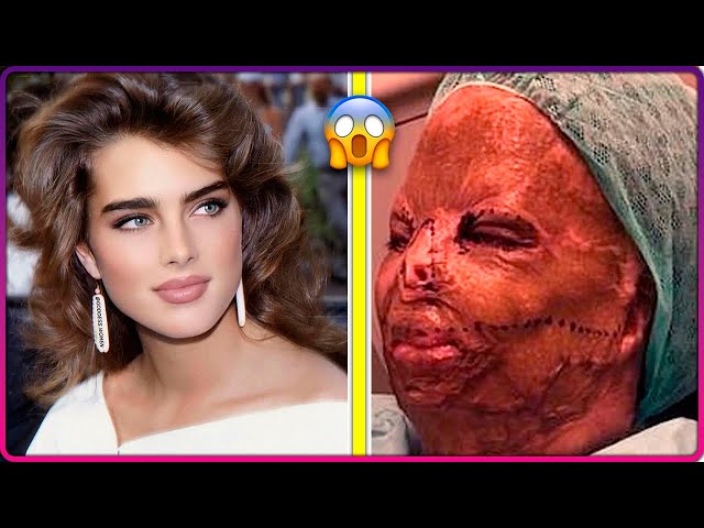 22 Surgeries That Went Terribly Wrong for Celebrities and Famous People