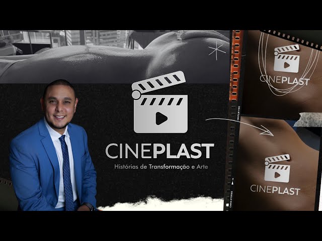 CINEPLAST: Histórias Reais no universo da Cirurgia Plástica