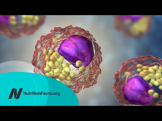 How Low Should You Go for Ideal LDL Cholesterol?