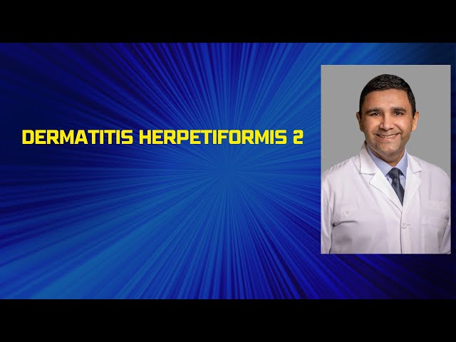 Dermatitis herpetiformis # 2