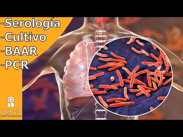 These are the laboratory tests to detect tuberculosis