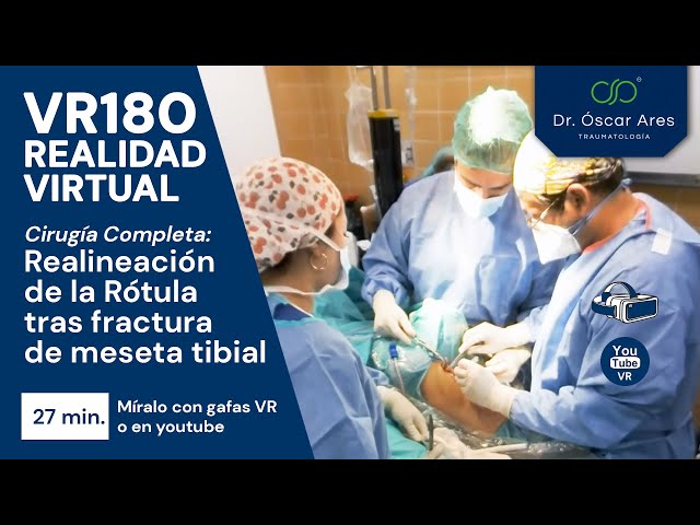 VR180 (Cirugía Completa) Realineación de la Rótula tras fractura de meseta tibial - Dr. Oscar Ares