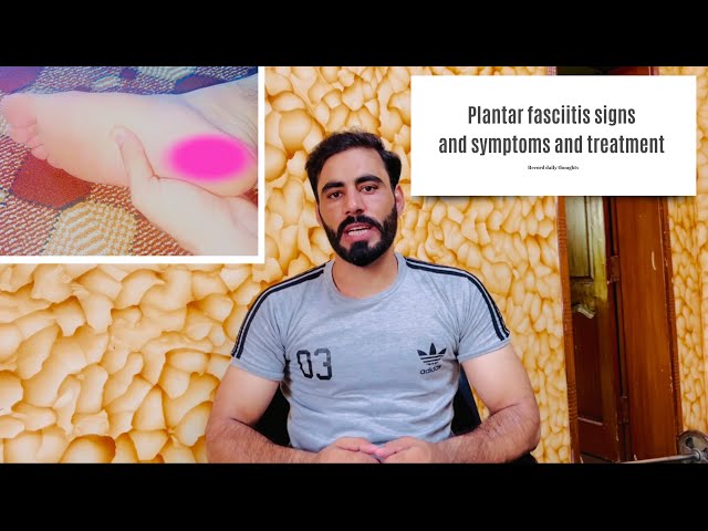 Plantar fasciitis and it treatment/five impressive exercises for plantar fasciitis