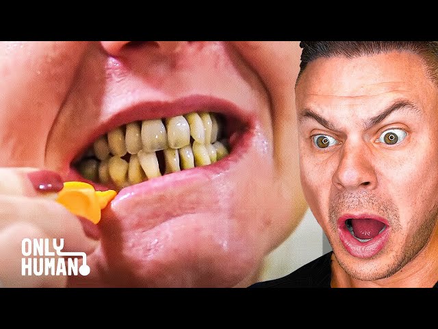 Dentist Reacts to "A Husband Who Has NEVER seen His Wife's Teeth" | Insane Smile Makeover!