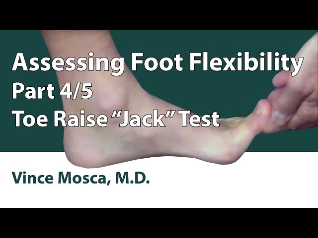 Assessing Foot Flexibility: Part 04 (Toe Raise "Jack" Test)