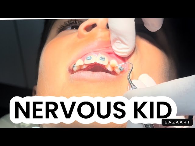 NERVOUS KID HAS TO GET TEETH PULLED