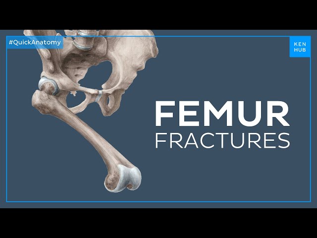 What happens when you fracture your femur - Quick Anatomy | Kenhub