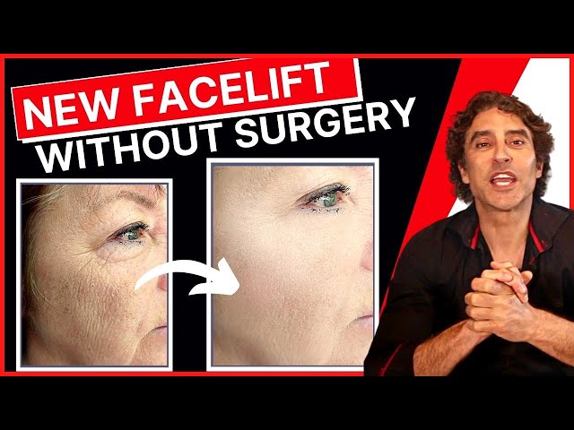 NEW PROCEDURE Facelift WITHOUT Surgery 🔥 Ellacor Micro Coring