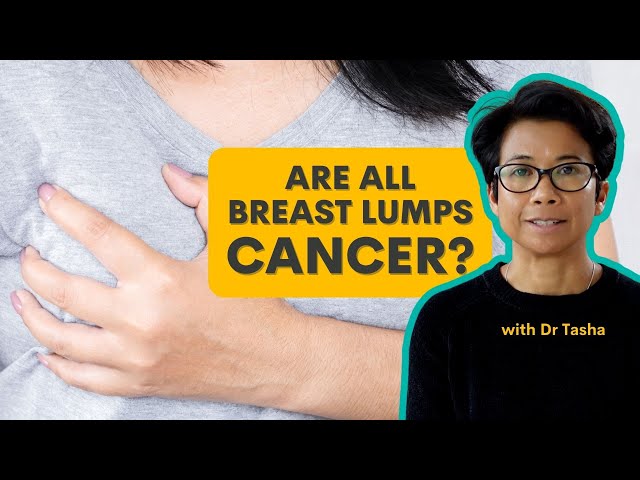 Are all Breast Lumps Cancer? - with Dr Tasha