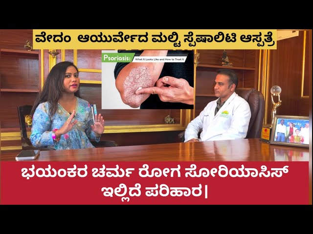 Psoriasis Can be Cure 😲| Dr M Ravi Raj psoriasis specialist Exclusive Interview | #vedam #psoriasis