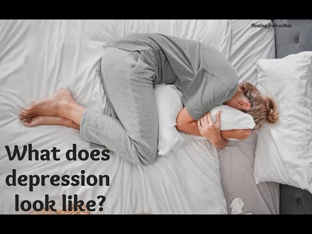 What does depression look like?