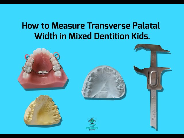 RPE? How to Measure Trans- Palatal / Intermolar Width in Mixed Dentition Kids.