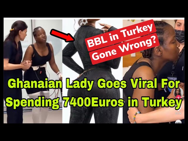 BREAKING: GHANAIAN LADY GOES V!RAL FOR SPENDING €7400 EUROS ON BBL AND TUMMY TUCK IN  TURKEY🔥