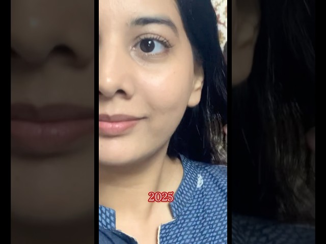 Skin Transformation | say bye to acne | clear skin #shorts #youtubeshort #clearskin #acne #skin