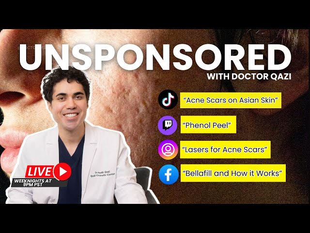 Dr. Qazi discusses Acne Scars, Phenol Peels, Lasers, TCA | Dr. Qazi Unsponsored Live | 1.9.2025