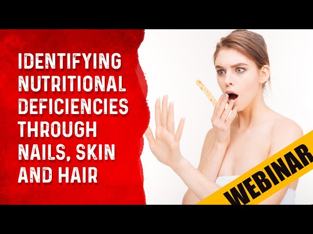 Identifying Nutritional Deficiencies Through Nails, Skin & Hair – Dr.Berg's Webinar