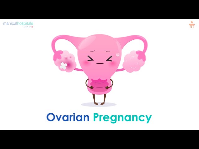 What is Ovarian Pregnancy? l Manipal Hospitals Bengaluru