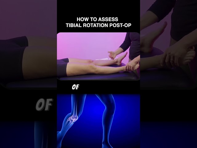 How to Assess Tibial Rotation Post - Op