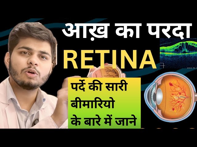 Eye retina | Aakh ka parda kiya hota hai | Diabetic retinopathy | आंख का पर्दा फटना