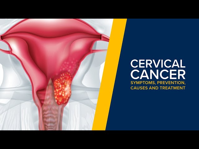 Cervical Cancer and HPV - Symptoms, Causes and Prevention Explained