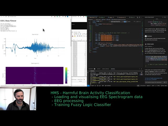 Mastering EEG Data Visualization: Plotly vs. Chart.js Showdown