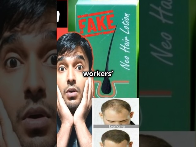 Shahrukh Khan used by Abuzer Ghori Dubai for Labor Exploitation Neo Hair lotion #denver #srk #dubai